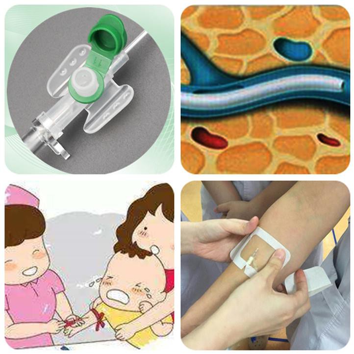 IV Cannula for Pediatrics